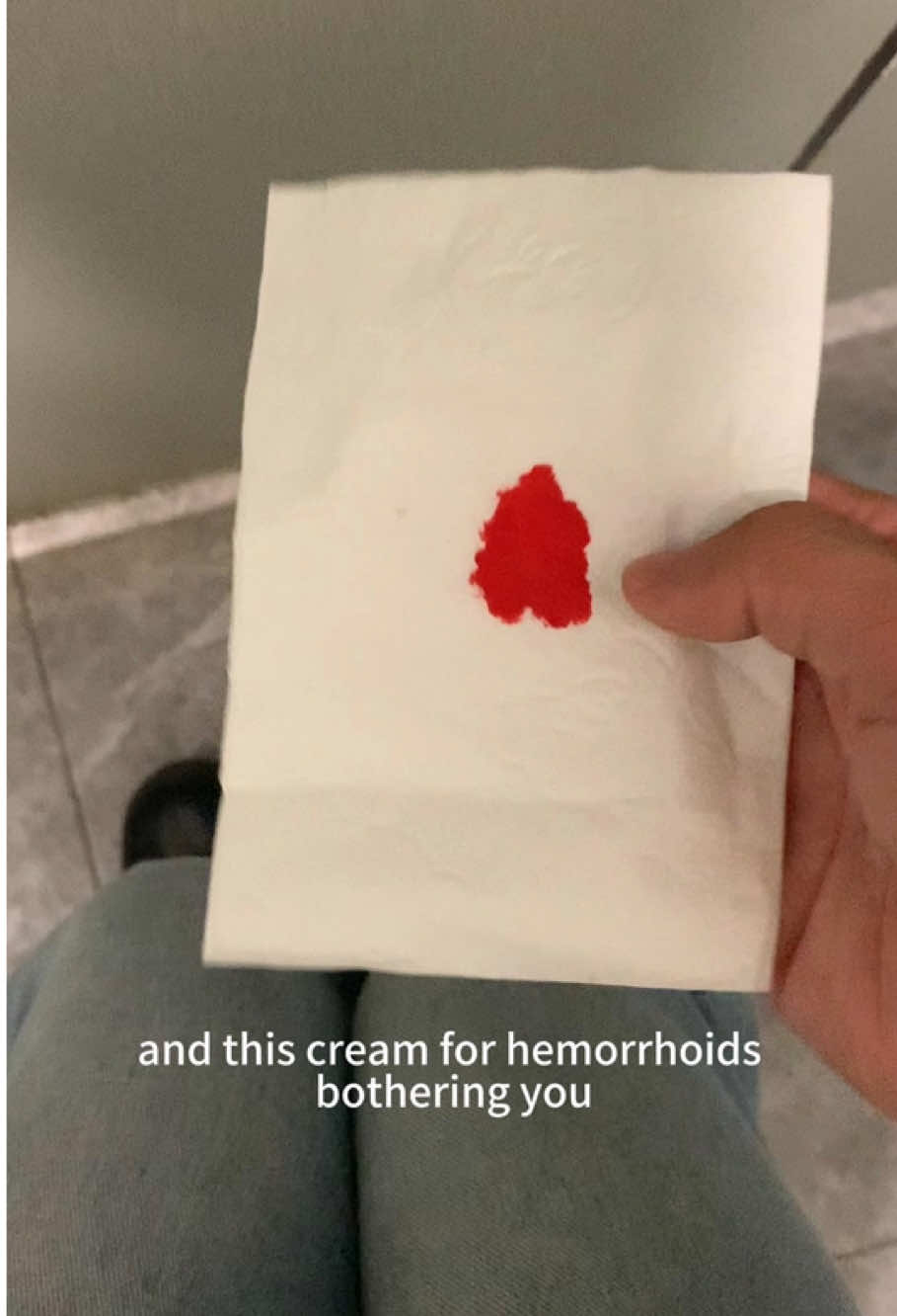 Stop suffering in silence—this cream actually works.  #hemorrhoids #relieffast #healthhack #hemorrhoidsrelief#vamy 