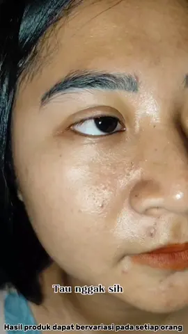 yang mau mukanya cerah bersih dan glowing ayo di co😍#springorigin #fachwashviral #affiliatemarketing #tiktokshop  #xbcyza #shop  #fyppppppppppppppppppppppp 