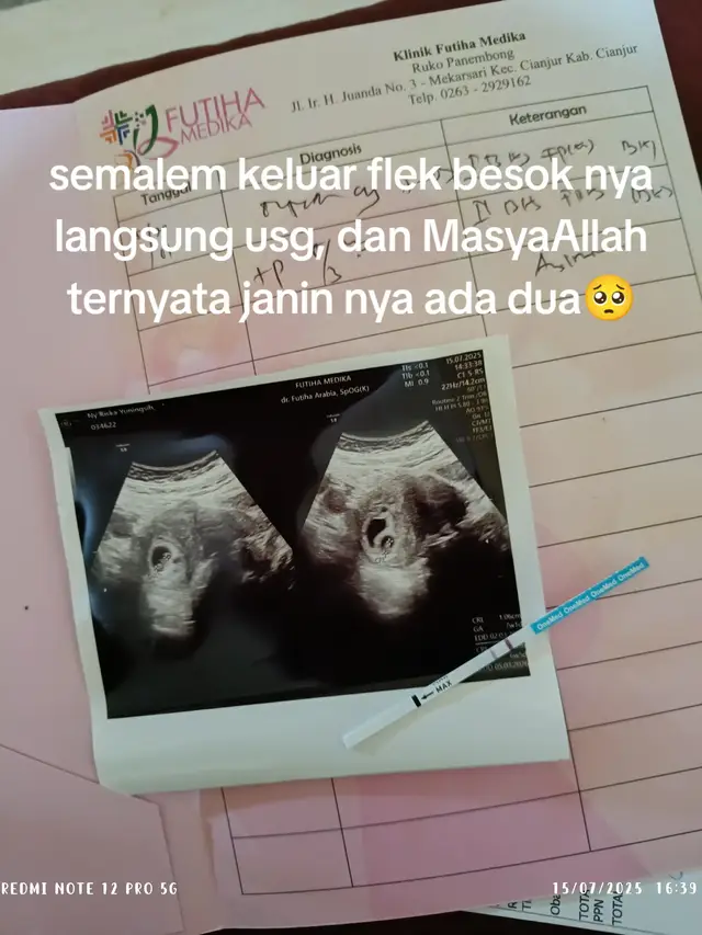 terharu ga nyangka banget di kasih sekaligus 2🥺 #masyaallahtabarakkallah #bayikembar #positifhamil