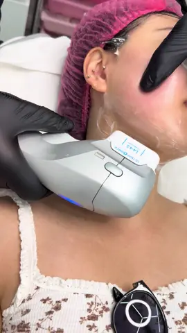 How does HIFU Ultraformer III define your jawline and reduce double chin? Ultraformer III uses focused ultrasound energy to target both fat and loose skin at the same time. 🔹 At deeper levels, it breaks down stubborn fat cells under the chin and jawline — helping to reduce the double chin. 🔹 At higher levels, it stimulates collagen production, which tightens and firms the skin. So in just one treatment, you get: ✅ Fat reduction ✅ Skin tightening ✅ A more sculpted, V-shaped jawline ✅ No needles, no downtime Most clients see visible results within a few weeks, with full improvement continuing over 2–3 months. 📍 London Finsbury Clinic 📞 07585 456338 📍 127 Fonthill Road, N4 3HH 📩 info@londonfinsburyclinic.co.uk ⸻ #ultraformeriii #jawlinedefinition #doublechinreduction #skinlifting #noninvasivetreatment #londonclinic #aestheticsclinic #vshape #ultrasoundtherapy #skintightening #londonfinsburyclinic #beautytreatmentlondon #northlondonbeauty #ultraformerjawline #nofilterneeded #naturallift 
