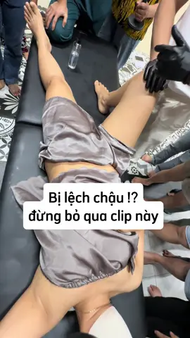 Lệch chậu do căng cơ háng ?? #vatlytrilieu #lệchchậu #daulung #trilieu  #suckhoechomoinguoi #chamsocsuckhoechudong  #longbien 