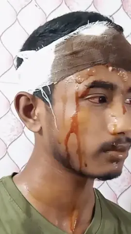 এতো ভালোবাসার পরেও মানুষ ভুলে যায় কেমনে #💔💔💔#ti̇ktok #viral 