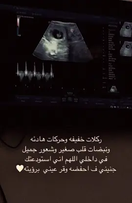 مااعرف اوصف شعوري لكم😔❤️🫶🏻#حملي_الاول #عشائرالعراق #حمل_وولادة #حمام_زاجل #العراق_السعوديه_الاردن_الخليج #بيي 