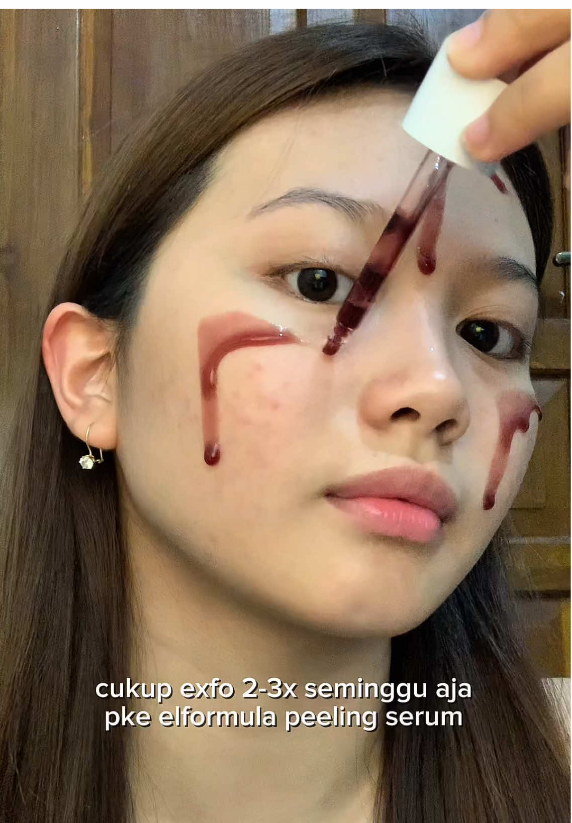 Ternyata cuma perlu rutin exfo buat hempas bruntusan aku 🥺❤️#PeelingSerum #Elformula