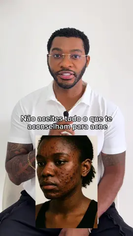 ⚠️ Não aceites tudo o que te aconselham para acne 🤦🏾 #acne #manchas #peleoleosa #skincare #panoxyl #nanicosmeticos #cosmeticos
