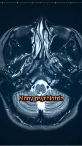Many psychiatric disorders share the same cause, according to new research.