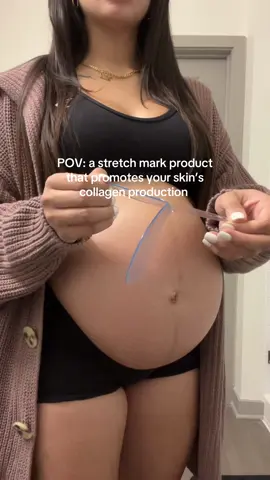 How does our Belly & Body Occlusion Patch help promote collagen production? One word: Occlusion! 🫧 Occlusion creates an environment that your skin thrives in, it traps moisture + heat, delivers moisture to all layers of the skin (even the dermis), boosts skin elasticity and increases your blood flow which in turn helps promote your collagen production ⭐️ #stretchmarks #stretchmark #stretchmarkremoval 