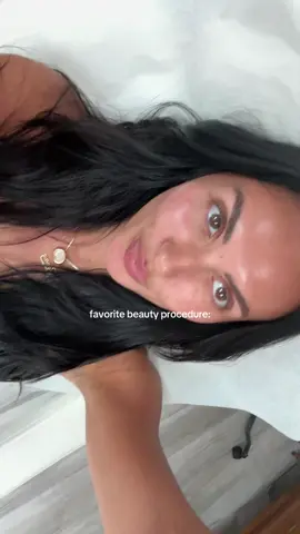 Microneedling/channeling + prp is my favvvv beauty procedure for the skin>>