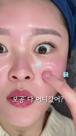 와.....피부 좋아져야 한다면  이거는 무조건이에요! 3개월치 예약 마비시킨  문의 폭주했던 이 관리.. 제가 직접하는데도  감탄밖에 안나옵니다 평소 피부 푸석하고  화장 잘 안먹고  속당김 엄청 심하신분들  이건 아묻따에요 코옆이랑 나비존  모공 타이트닝 미쳤고  피부속에서 부터 차오르는 속광이...와 피부 속부터 바뀌는 올인원케어  피부결, 속보습까지 꽉 잡히고 다운타임 없음 📌이 관리 궁금하시다면 프로필 하단 링크 클릭해주세요 카카오채널 “스킨신나라”로 유리알 이라고 보내주세요