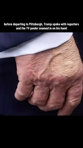 Weekend at Bernie’s  #fyp #hands #coverup 