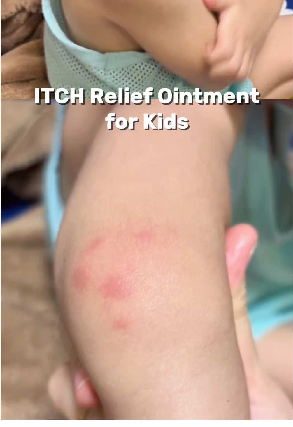 Kung kagatin ng lamok or kahit anong insekto si baby, Eto ang magandang ipagamit sakanila. Ako eto ang gamit ko sa anak ko 🙂 #hegerbaby #itchreliefointment #babyessentials #babyneeds 