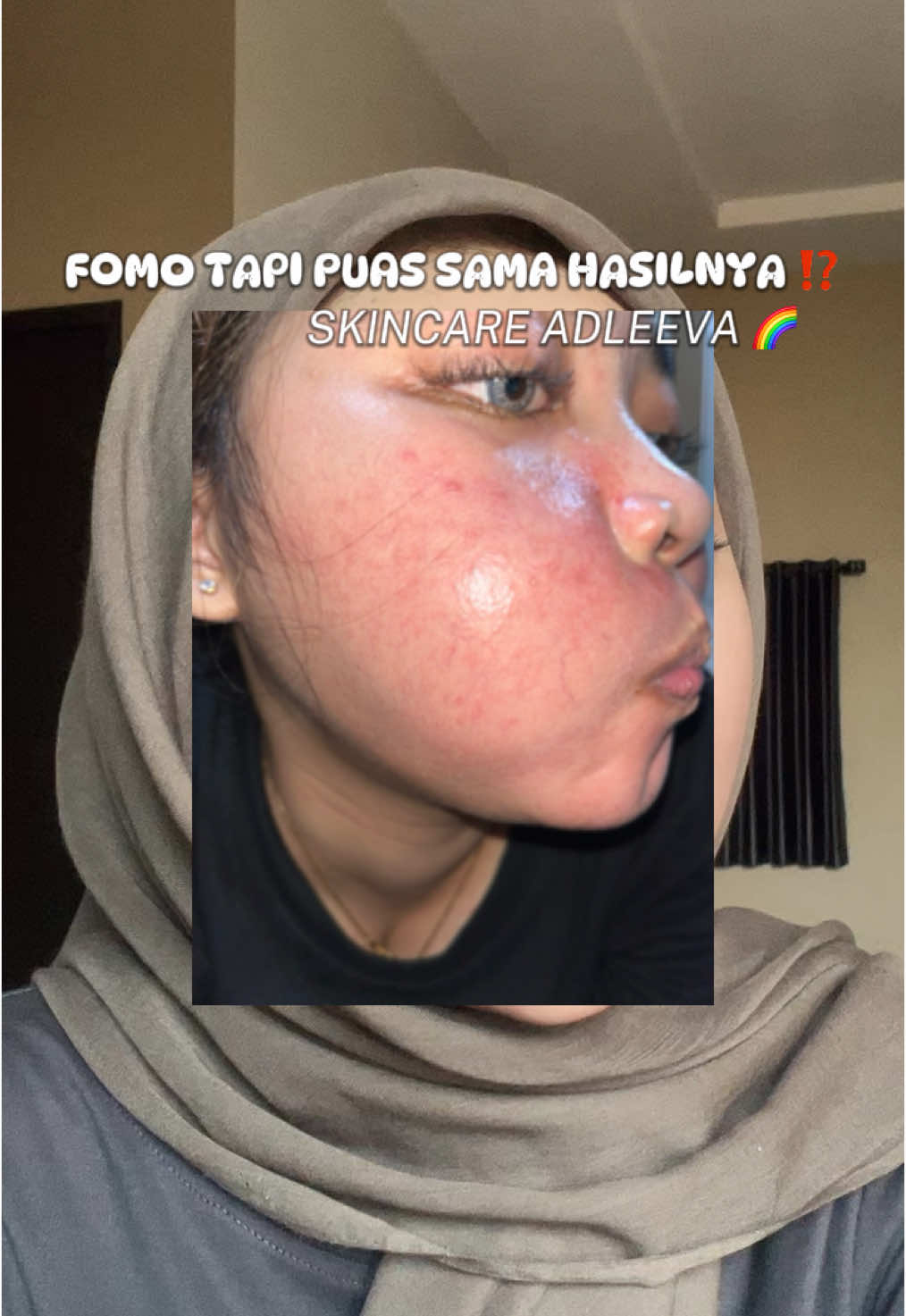 Happy bangettttt 🥹 semoga @Adleeva bakal terus produksi sampe aku tua yaaa! 😭🙏🏻 #fyp #viral #adleeva #adleevaskincare #adleevareview #adleevaskincareku💖 #adleevaofficial #adleevaskincareku 
