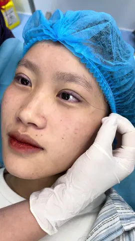 Thay đổi 1 chút cho cửa sổ tâm hồn ✅ #nhanmi #nhanmitunhien #nhanmiplasma #pttm #xuhuong 