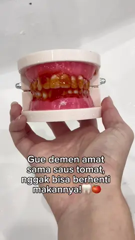 Gue demen amat sama saus tomat, nggak bisa berhenti makannya!🦷🍅#usmile #usmilecy1 #teethcare #funny #teethcleaning #teeth #CapCut 