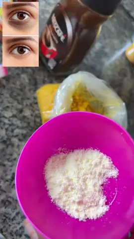 Reera dhafar aad idiin anfacee intaas indhaha hoostada kariya waa huruud, caano, malap, iyo coffee weel ku shubo indhaha hostoda marso 30 min Ka dibna iska dhaq ka so dalbo lambarka profilka Saran wixii dalab ah#617635307👈🏼👈🏼 #flow 