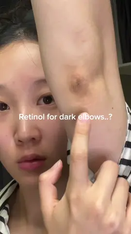 Retinol for dark elbows..? . #spiculeampoule #centella #centellaskincare #skincare #skin1004 #koreanskincare #ampoule #serum #skincareroutine #kbeauty #skincareproducts #retinol @SKIN1004 US 