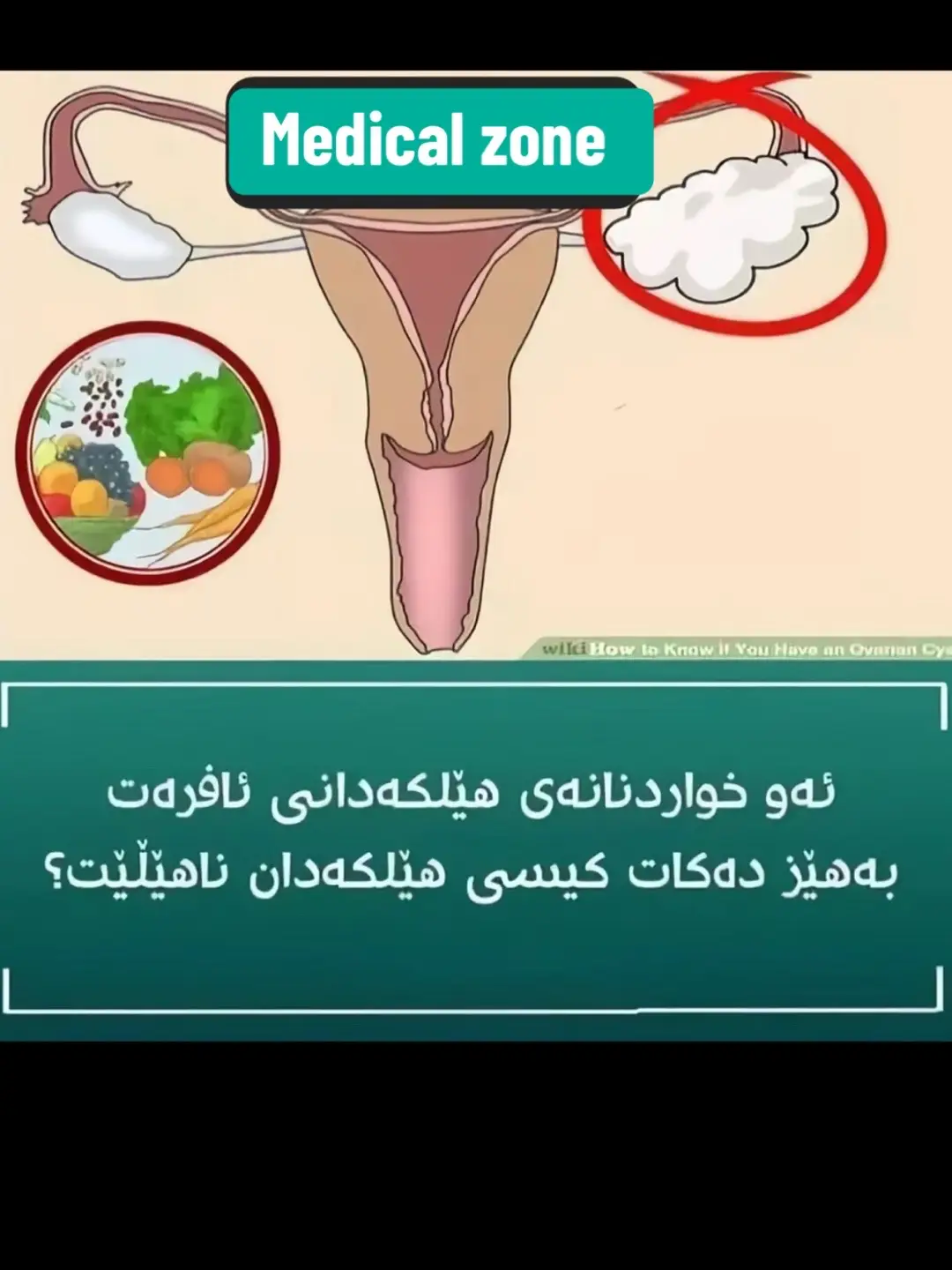 #زانیاری_پزیشکی_کوردی #تەندروستی #medical_zone #health #healthcare #medical 