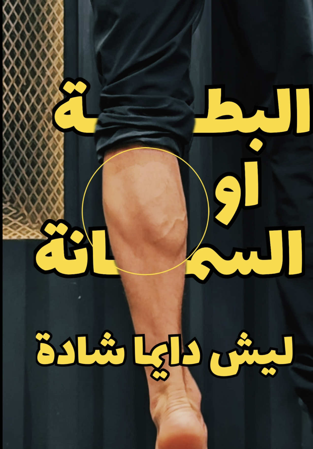 ⁨	عضلة السمانة (calve muscles) عضلة بتحملك يومياً وبتساعدك بحياتك فلازم تقويها عشان ما تشد عليك  التمرين الاول : ١٠ عدات جولتين عكل رجل  التمرين الثاني : ١٠-٢٠ عدة جولتين عكل رجل  التمرين الثالث : ثبات ٣٠ ثانية جولتين عكل رجل   بتسويهم من ٢ ل ٣ مرات بالاسبوع  التمارين هدول مهمين لو كنت رياضي ورياضتك فيها جري واستخدام ثقيل لهاي العضلة  #تمرين #calisthenics #physiotherapy #رياضة #علاج_طبيعي #gym #Fitness #calves⁩