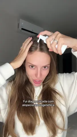 Alopecia girls vamos nos ajudar 🩷