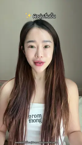 ไม่รู้คิดไปเองมั้ย แต่รู้สึกว่าผิวมันดีขึ้นจริง 🥹✨  ลอง JIL WINK มา 7 วัน ผิวนุ่มขึ้นจนจับแล้วตกใจ  มีวิตามิน 5 ตัวรวมในเม็ดเดียว ง่ายมากแถมไม่ต้องกินเยอะ   #JILWINK #JILWINKวิตามินผิว #จิลวิงซ์ #DrJiLLl #วิตามินบํารุงผิว #วิตามินร่างทอง #รีวิวบิวตี้