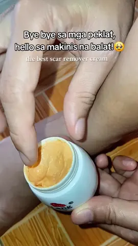 worth it ang pagbili neto🥰 #baiyaolang #baiyaolangcream #scarremover #peklat #peklatcream #cream #herbalcream #fypシ゚ 