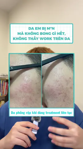 Không phải cứ bong trong là thể hiện hiệu quả tốt.  #goclamdep #trunghieu3099 #skincare #skincaretips  #CeraVePartner #cerave #ceravevietnam #chamsocda  #tacdongkep #khepvonglapmun