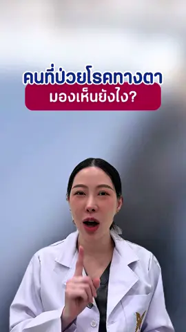 มองเห็นแบบไหนถ้าเรามีโรคเกี่ยวกับตา👀 #รู้หรือไม่ #หมอหลิงบีพราวด์ #knowledge #จักษุแพทย์ #ความรู้ #tiktok 