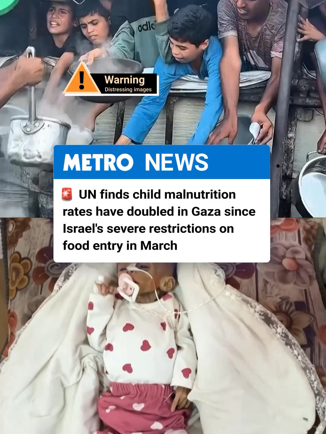 The the rate of malnutrition among children in the Gaza Strip has doubled since Israel severely restricted food entry in March, the UN reported this week. The reported detailed that 10.2% of nearly 16,000 children under age 5 who were screened at UN clinics in June were found to be acutely malnourished. By comparison, in March, 5.5% of the nearly 15,000 children it screened were malnourished. #middleast #middleastnews #malnutrition