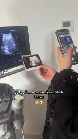 #عيون خالتوا😭👶🏼♥️@Renado.🇸🇾 #typ #explore #اكسبلورexplore 