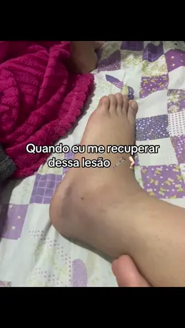 🦴 Microfraturas, ligamentos rompidos e muito inchaço… O tornozelo pediu pausa, mas a força continua firme! 💪🦶 #ressonancia #lesao #tornozelo #recuperacao #vidareal #forçasemparar 