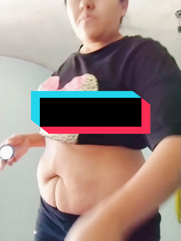 #paratiiiiiiiiiiiiiiiiiiiiiiiiiiiiiii #ajoenelombligo #viraltiktok 