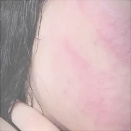 #واجه يطكني#