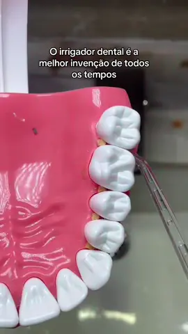 OBS: o irrigador NÃO substitui o uso do fio dental  os tempos #dentes #paciente #dentista #odontologia 