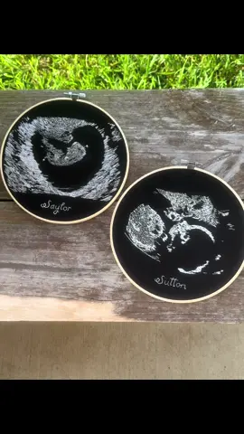 I got these precious gifts in the mail. Both of our babies last ultrasounds.  Our Angel Girl that we lost at 11 weeks in October 2022  Our Rainbow Baby Boy that is 20 months and thriving 🤍 such a beautiful way to capture both of the lives we’ve made 😍