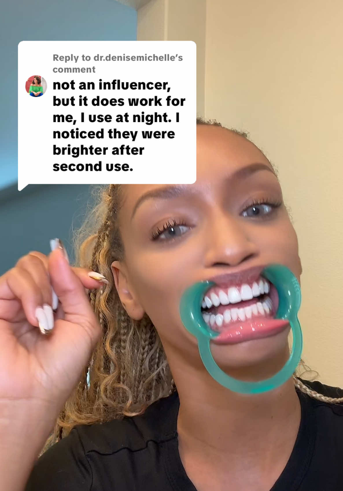 Replying to @dr.denisemichelle Yes this really works to get whiter teeth QUICKLY 🙏🏽💯  #gurunanda #teethwhitening #gurunandawirelesswhiteningnewarrival #dealsforyoudays #whiteteeth #whiteningstrips @GuruNanda LLC 
