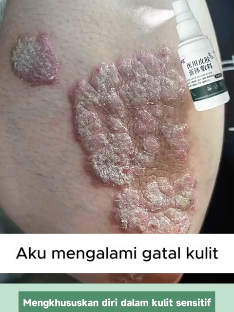 Semprotan Kulit Sentuhan Alam, di mana kekuatan tumbuhan murni bertemu dengan perawatan lembut.