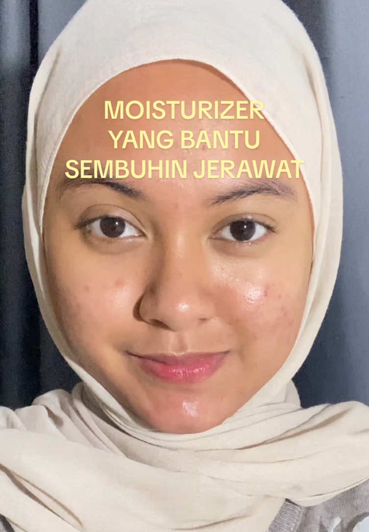 andalan aku buat sembuhin jerawat pake moisturizer dari YOU🥰🥰🥰 #jeratjerawat #skincareroutine #jerawatsembuh #fyp 
