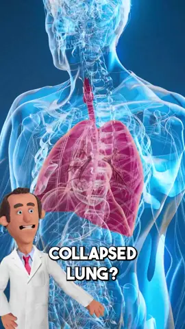 What is a collapsed lung? follow Dr. Pickle for MORE ‼️ #doctor #health