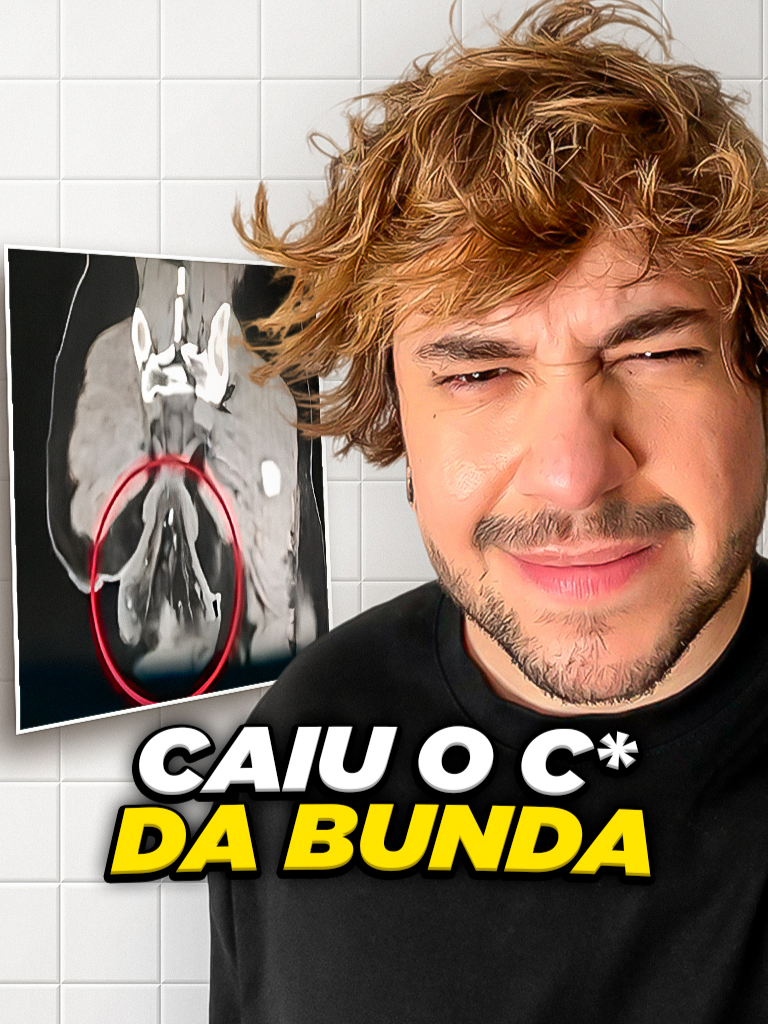 caiu o c* da bunda @renatapena_curiosidades #livedobrino #humor