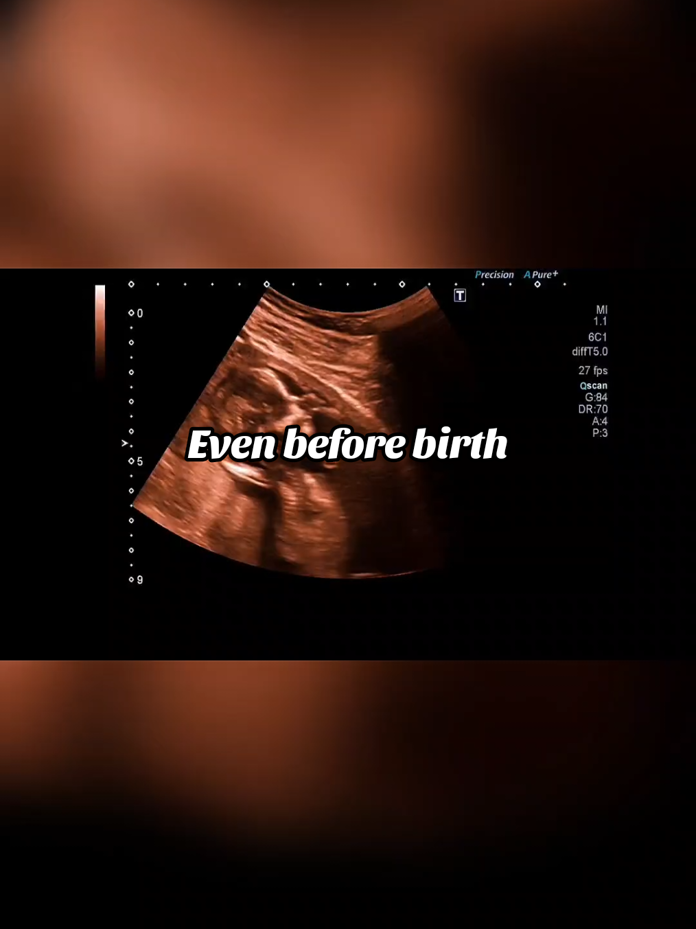 Every heartbeat counts… even the tiniest one inside the womb. Every life is precious, unique, and irreplaceable. Even before birth.   Do you believe every life deserves a chance? Leave a heart in the comments if you agree! #prolife  #chooselife  #everylifematters #savethebabies  #lifeisprecious #lovethemboth #fyp  #vira  #pregnancy  #eeuu 