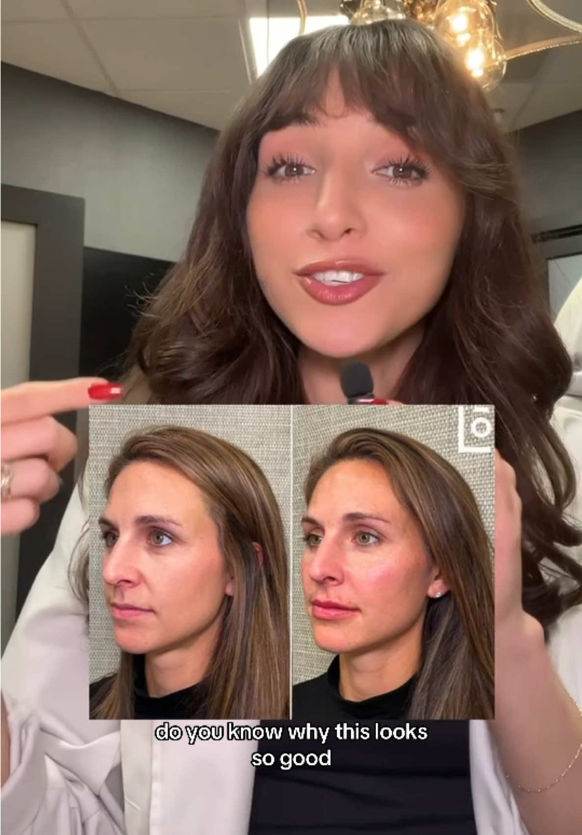 Do you know why this looks good? Because it was done right 👏 Cheek filler isn’t about volume — it’s about structure, balance, and lift 💉 @Kennedy | Aesthetic Injector  🗓️ Love your look—Book your appointment today at LookLab.com or call 833.999.5665 (LOOK) #MedSpa #Filler #CheekFiller 
