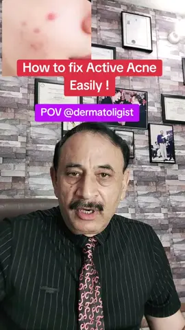 How to manage active acne. in active acne cases, topical antibiotics are preferred and oral antibiotics are advised if needed in severe cases #acne#acnefighter #acnetreatments #acneproneskin #acneskincare #hormonalimbalance #pcod #skunkstripe #skincare #openpores 