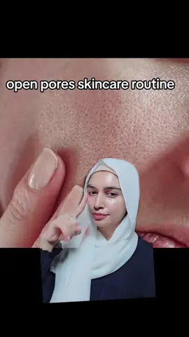 #skincare appointment k lye Instagram hoor_skincare_beauty pr inbox kry #skincare  @LaRochePosayUS  @L’Oréal Paris #openpores #skincare ##beauty ##fyp ##unfreezemyacount #beauty #openpores #skincare #greenscreen 