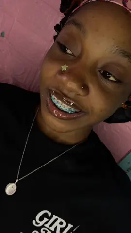 #creatorsearchinsights #CapCut #twinklebraces #fashionbraces #jamaicantiktok #jamaicantiktok🇯🇲viral #blowup #viralvideos #fypシ゚ #fyp #fakebraces #foryoupage #viraltiktokvideo #fyppp #teethwhitening 