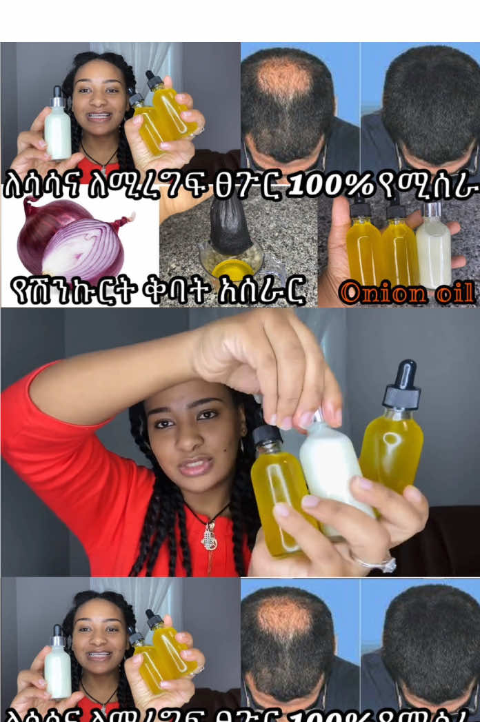 Best onion oil and serum for hair growth and hair loss/የሽንኩርት ቅባትና ሴረም አሰራር ለፀጉር ብዛት ለሚነቀል ፀጉር የሚጠቅም   #v#viralh#hairgrowthh#homemadeh#hairh#hairoilo#onione#ethiopian_tik_tok