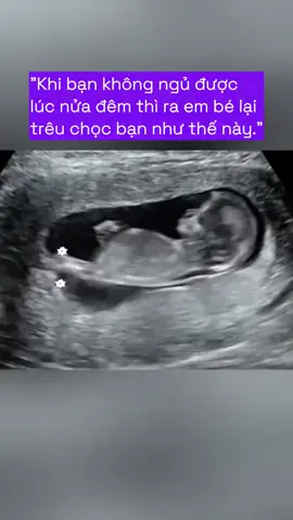 Cứ đạp thế này mẹ nào ngủ cho được 😂 #duocsinguyenngoc  #hiemmuonmongcon  #mangthaitunhien  #thaikykhoemanh  #mangthailandau  #suckhoesinhsan🥰
