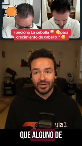 #tip #cebolla #cabello #fyp #parati #usa #mexico #mexico🇲🇽 #pelon #calvo 