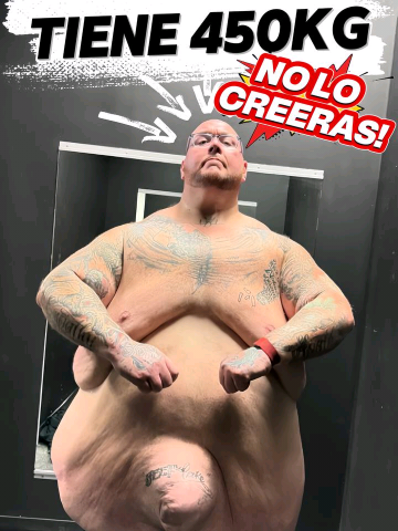 🔥 ESTE HOMBRE DE ESTADOS UNIDOS PESABA 450 KG… ¡Y HOY NADIE LO CREE! 😱💪 #news #vyp #foryoupage❤️❤️ #unitedstates #eeuu #viralvideos #sportlover #fyp 