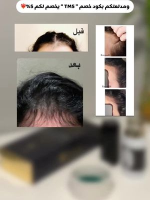 وش تنتظر؟ اطلب الان بخصم10% بكود A49