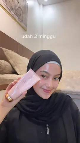 paling ampuh buat bekas jerawat aku siii 💗 #glowiesbeauty 
